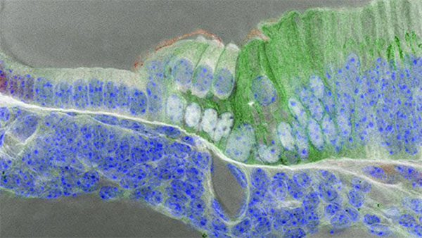 Drs. Brent Wilkerson, Taha Jan, Mirko Scheibinger, Stanford Medicine Section of an embryonic mouse inner ear. Drs. Brent Wilkerson, Taha Jan, Mirko Scheibinger, Stanford Medicine