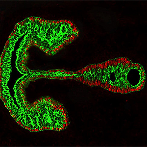 Developing mouse vocal fold tissue in the embryonic mouse. Drs. Vlasta Lungova and Susan Thibeault, University of Wisconsin–Madison