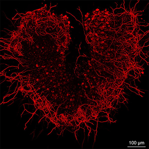 Cultured spiral ganglion neurons (auditory nerve cells) from the inner ear. Dr. Alain Dabdoub, Sunnybrook Health Sciences Centre and Dr. Mirko Scheibinger, Stanford Medicine