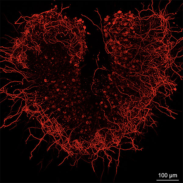 Dr. Alain Dabdoub, Sunnybrook Health Sciences Centre and Dr. Mirko Scheibinger, Stanford Medicine Cultured spiral ganglion neurons (auditory nerve cells) from the inner ear. Dr. Alain Dabdoub, Sunnybrook Health Sciences Centre and Dr. Mirko Scheibinger, Stanford Medicine