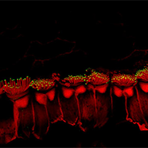 Enhanced microscopic image showing hair-like projections (stereocilia) on the sensory hair cells in the inner ear of a mouse model treated with inner ear gene therapy. The mouse has a genetic form of deafness that causes the stereocilia to be short and defective. Gene therapy elongated the stereocilia and improved hearing. Kevin Isgrig, NIDCD