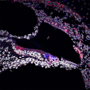 Confocal image of a row of sensory inner hair cells in red (TRIOBP-5 in green) from a shaker-2 mutant mouse. Dr. Rabia Faridi, NIDCD